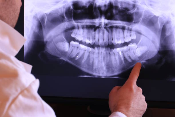 Best Emergency Dental Care for Abscessed Tooth in Vashon, WA